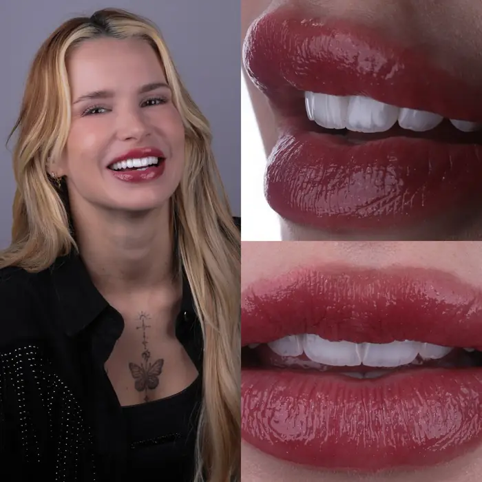 Resultado real 8 - sorriso transformado pela Clínica Viotto