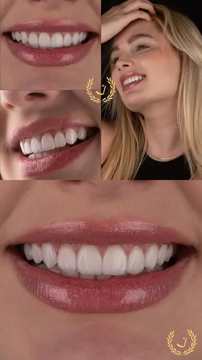 Resultado real 1 - sorriso transformado pela Clínica Viotto